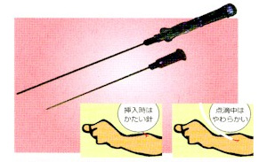 留置針